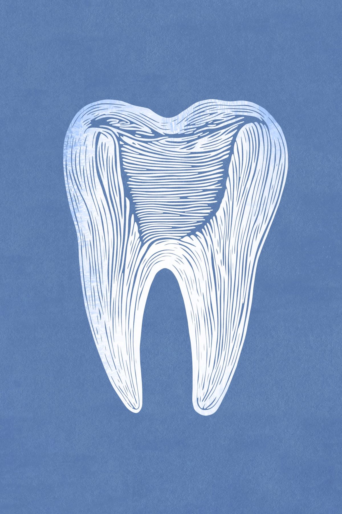 Solid Molar